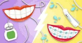 Что лучше выбрать: зубную нить или ирригатор?