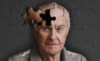 Ученые сумели предугадывать болезнь Альцгеймера