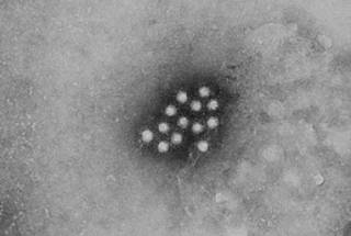 Гепатит А в Винницкой области: ситуация ухудшается