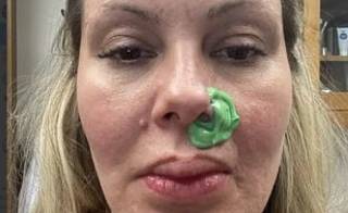 Криста Карсон: у певицы отвалился нос после инъекции ботокса