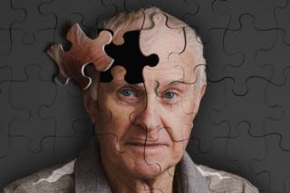 Ученые выявили пять различных типов болезни Альцгеймера