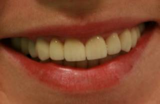 Названа неочевидная причина проблем с зубами у женщин