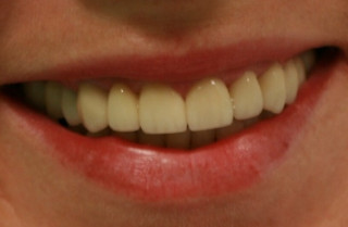 Названо неочевидну причину проблем із зубами у жінок