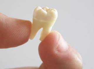 Как оказалось, потеря зубов ведет к ожирению