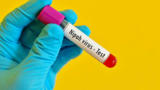 Смертельний вірус Nipah атакував Індію