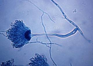 Aspergillus: миру угрожает жуткий грибок