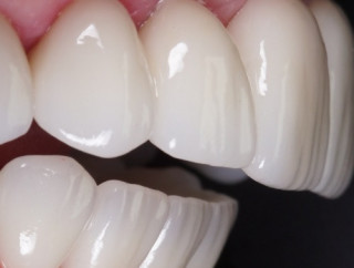 Вчені дізналися про походження зубів щось цікаве