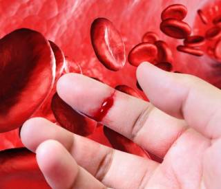 Расторопша: сгущает кровь или разжижает?