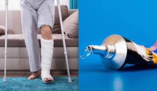 Ученые создали «суперклей» для костей, который заживляет переломы за считанные минуты