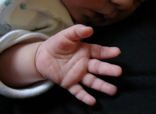 У немовлят виявлено новий тип діабету