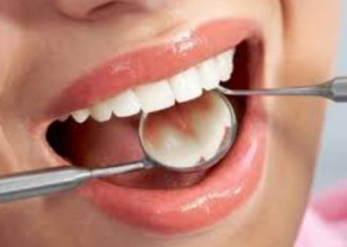 Американці озвучили простий спосіб захисту від карієсу