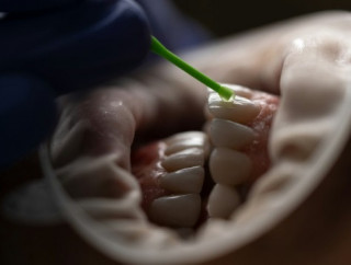 Озвучено дивний провісник передчасної смерті