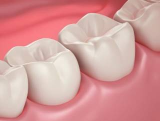 Создан гель против кариеса