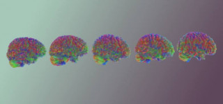 Підліткова фаза розвитку мозку триває... до 32 років, - вчені